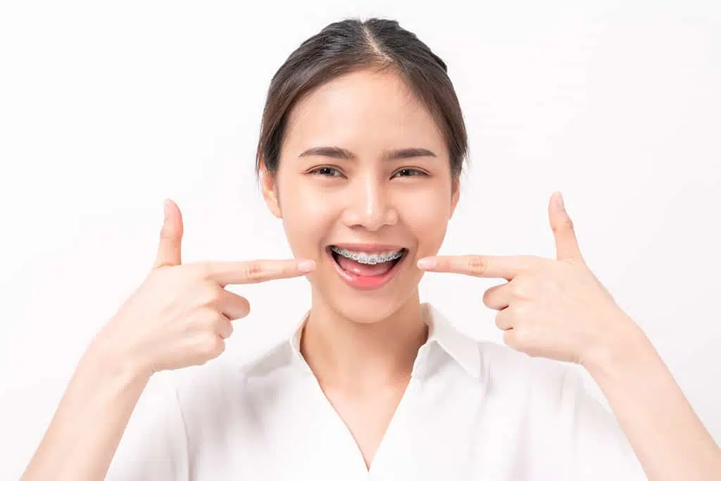 panduan pasang behel metal - klinik gigi sozo dental