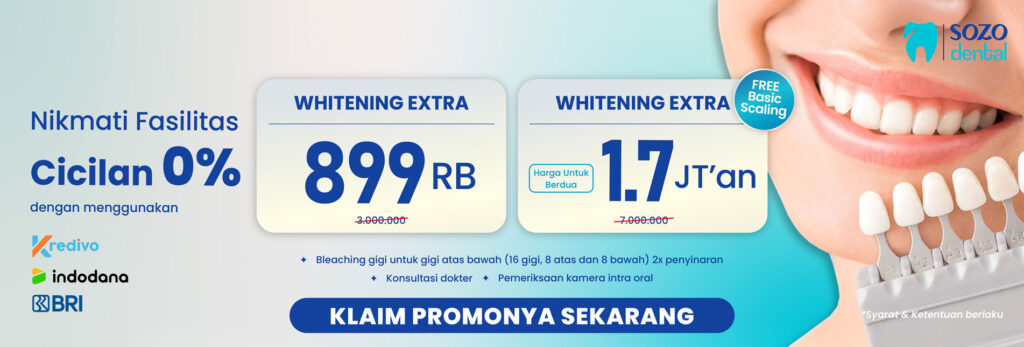 promo september - bleaching teeth whitening