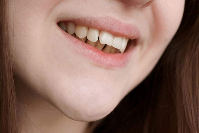 ciri-ciri gigi tonggos - sozo dental