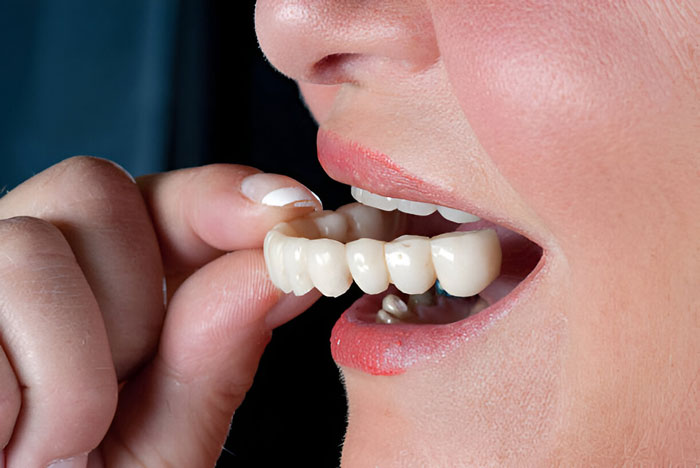 gigi palsu lepasan sozo dental