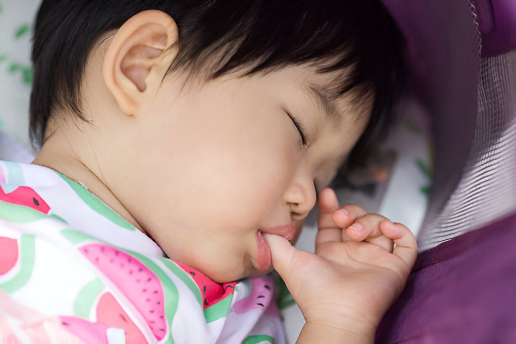 kebiasaan mengisap jempol bikin gigi maju - sozo dental - penyebab gigi overbite