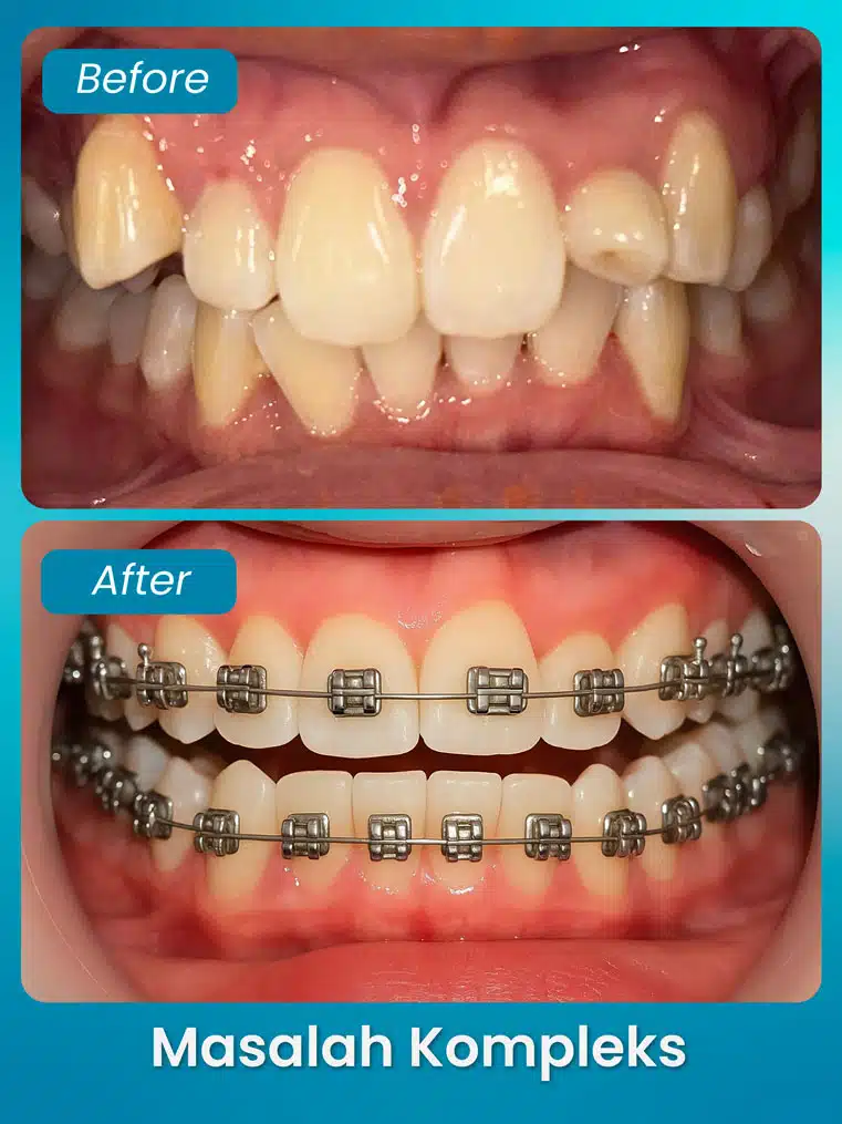 masalah kompleks 2 - xpert by sozo dental