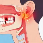 Kenapa Rahang Sakit? Penyebab dari Gigi hingga Sendi & Kapan Harus Cek