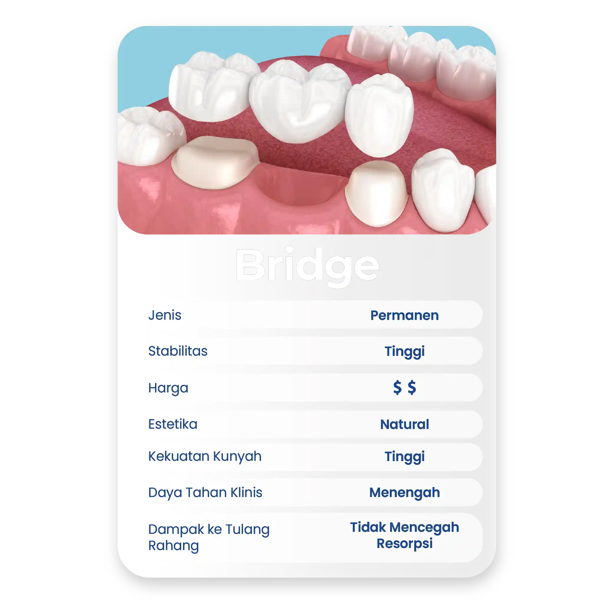 UPDATE SIA_Tabel Bridge