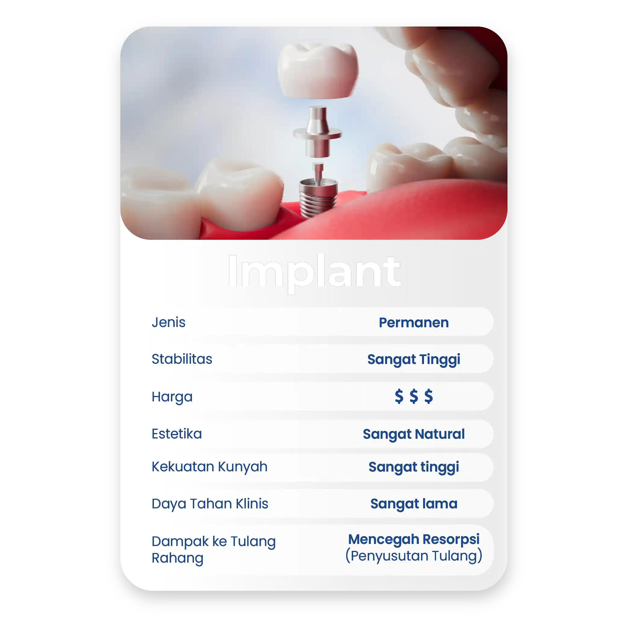 UPDATE SIA_Tabel Implan