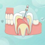 Kapan Pulpektomi Diperlukan pada Gigi Susu Anak? Ketahui Faktanya