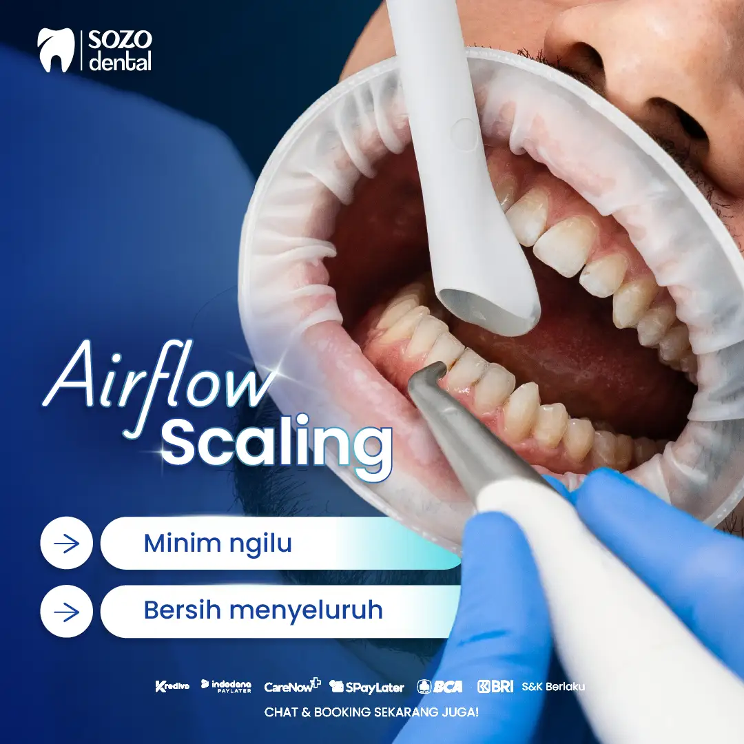 biaya bersihin karang gigi - airflow scaling - klinik gigi sozo dental